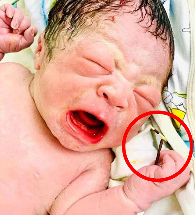 new baby with contraceptive