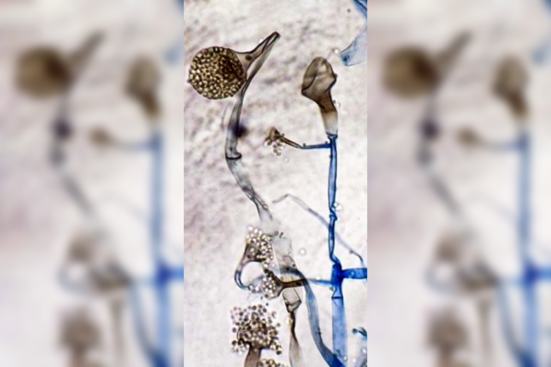 mucor fungal spores
